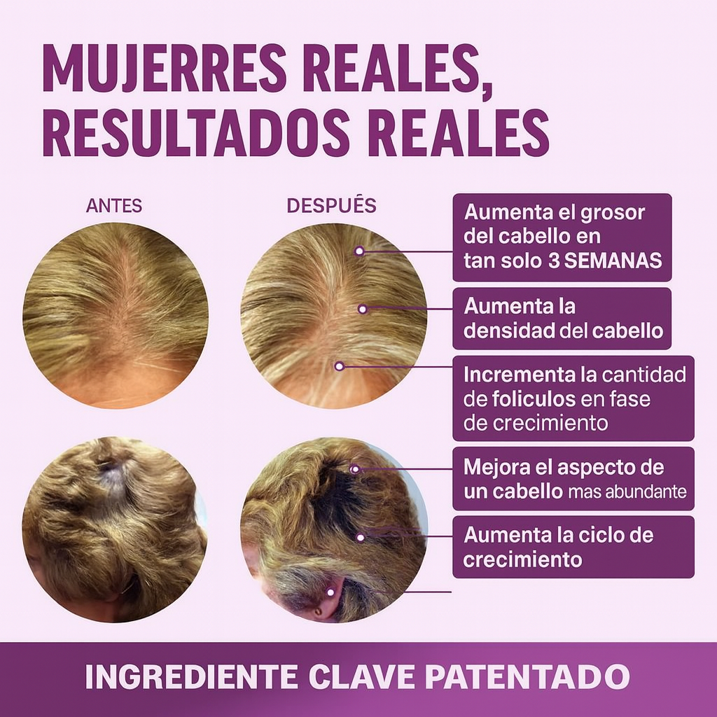 Gomitas Crecimiento Capilar Hair Growth