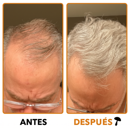 GOMITAS DIARIAS HAIR GROWTH